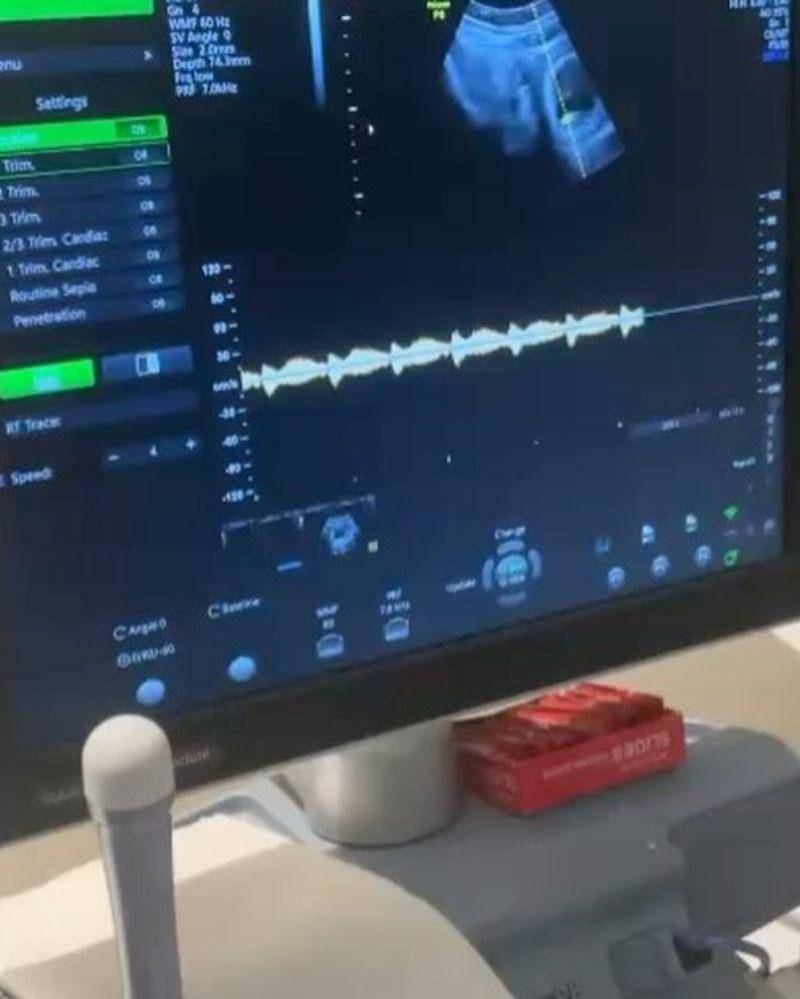 Instagram.com/neida_aleida